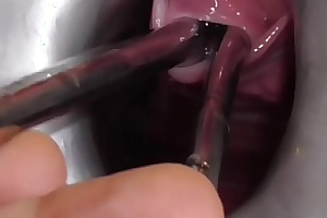 Analslut multiple sounds - james is stretching the brush urethra with multiple sounds - peeing into the brush gaping cunt